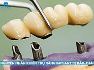 Trụ răng Implant bị đào thải do đâu và hướng xử lý hiệu quả?