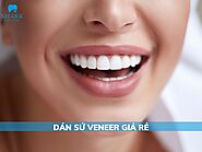 Dán sứ Veneer giá rẻ có nên hay không và cần phải chú ý gì?