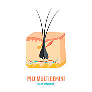 What Is Pili Multigemini?