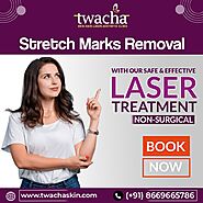 Best Stretch Marks Removal laser treatment - Twacha