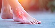 Best Plantar Fasciitis Treatment Exercises?