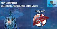Fatty Liver Disease: Understanding the Condition and its Causes