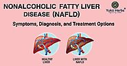 Non-alcoholic Fatty Liver Disease (NAFLD): Symptoms, Diagnosis, and Ayurvedic Treatment