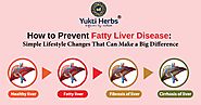 How to Prevent Fatty Liver Disease: Simple Lifestyle Changes That Can Make a Big Difference.