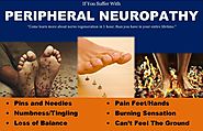 What is Peripheral Neuropathy? Classification & Differential Diagnosis -