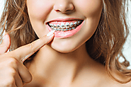 Finding the Right Orthodontist in Gurgaon: Tips and Considerations for Choosing the Best Provider for Your Dental Needs