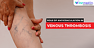 Role of anticoagulation in venous thrombosis
