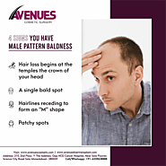 Best Hair Loss Treatment Clinic in Ahmedabad, Avenues Cosmetic
