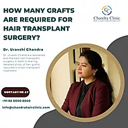 How Many Grafts are Required for Hair Transplant Surgery?