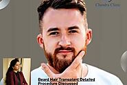 Beard Hair Transplant Detailed Procedure Discussed