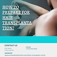 How to Prepare for Hair Transplantation? - Chandra Clinic
