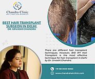 Hair Transplant in Delhi - Hair Transplant Technology in Delhi at Chandra Clinic will Amaze Your