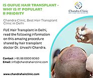 FUE Hair Transplant in Delhi at Chandra Clinic