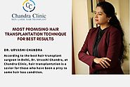 Most Promising Hair Transplantation Technique for Best Results