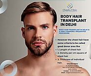 Body Hair Transplant in Delhi - Chandra Clinic