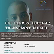 FUE Hair Transplant in Delhi - Expert Hair Transplant Surgeon in Delhi