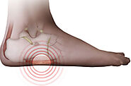 Physical Therapy Exercises For Foot Pain