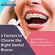 3 Factors to Choose the Right Dental Braces