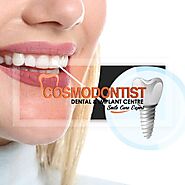 Dental Implant Cost in Gurgaon : 2023 Update Price List