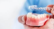Invisible Braces Cost In Gurgaon