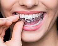 Invisible Teeth Aligners in Gurgaon