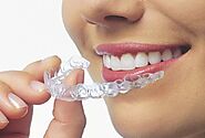 Achieving a Perfect Smile with Invisible Teeth Aligners in Gurgaon