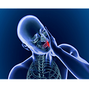 Trigeminal neuralgia - Neurologists in Purnia