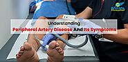 Understanding Peripheral Artery Disease And Its Symptoms