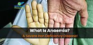 What Is Anaemia? A Severe Iron Deficiency Disease!