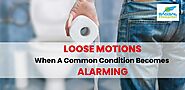 Loose Motions: When A Common Condition Becomes Alarming