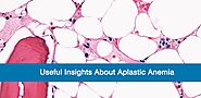 Useful Insights About Aplastic Anemia
