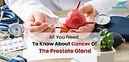 All You Need To Know About Cancer Of The Prostate Gland