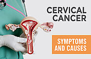 What Is Cervical Cancer? Understanding Its Significance