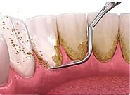 outlookdentalmckinney Outlook Dental provides best treatment for gum disease in McKinney, Texas