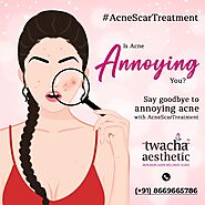 the best acne skin treatment