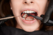 How often do fillings need to be replaced?