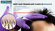 Transform Your Hair, Transform Your Life: The Ultimate Hair Transplant Guide