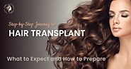 Step-by-Step Journey to Hair Transplant: What to Expect and How to Prepare