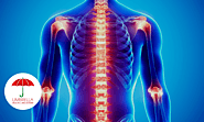 Causes of rheumatoid arthritis