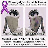 Effective Natural Treatments For Fibromyalgia