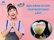 Bọc răng sứ kim loại được bao lâu? Mẹo giúp tăng tuổi thọ