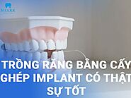 Trồng răng bằng cấy ghép implant có thật sự tốt không?
