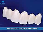 Răng sứ Vita là gì? Giá bao nhiêu tiền? Có tốt không?