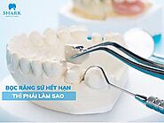 Răng sứ hết hạn phải làm sao? Những dấu hiệu nhận biết