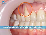 Nguyên nhân lợi không bám vào chân răng và cách điều trị 