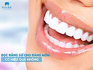 Phương pháp bọc răng sứ cho răng móm có hiệu quả không?