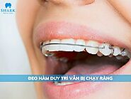 Đeo hàm duy trì vẫn bị chạy răng: Nguyên nhân và cách khắc phục