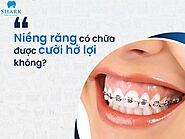 Niềng răng chữa cười hở lợi có hiệu quả không?