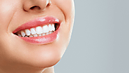 Top 5 Tips to Maintain Smile After Teeth Whitening