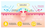 Acne patches